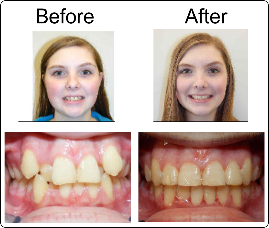 Boni Orthodontics 