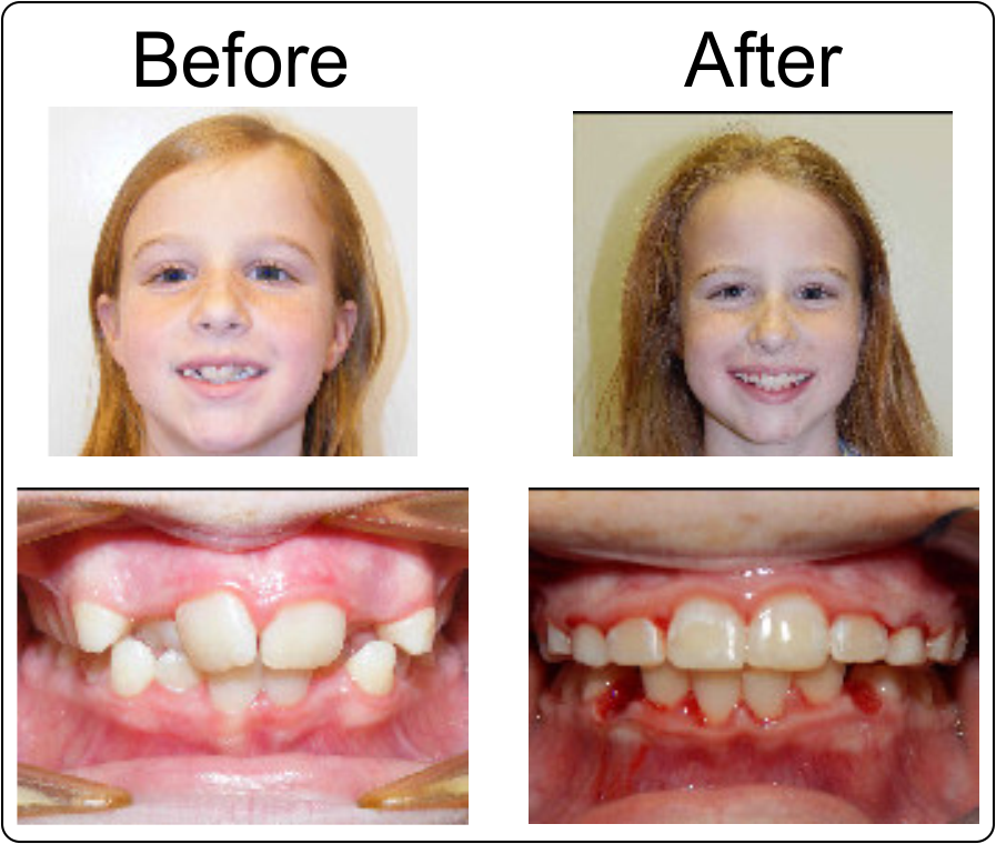 Boni Orthodontics 